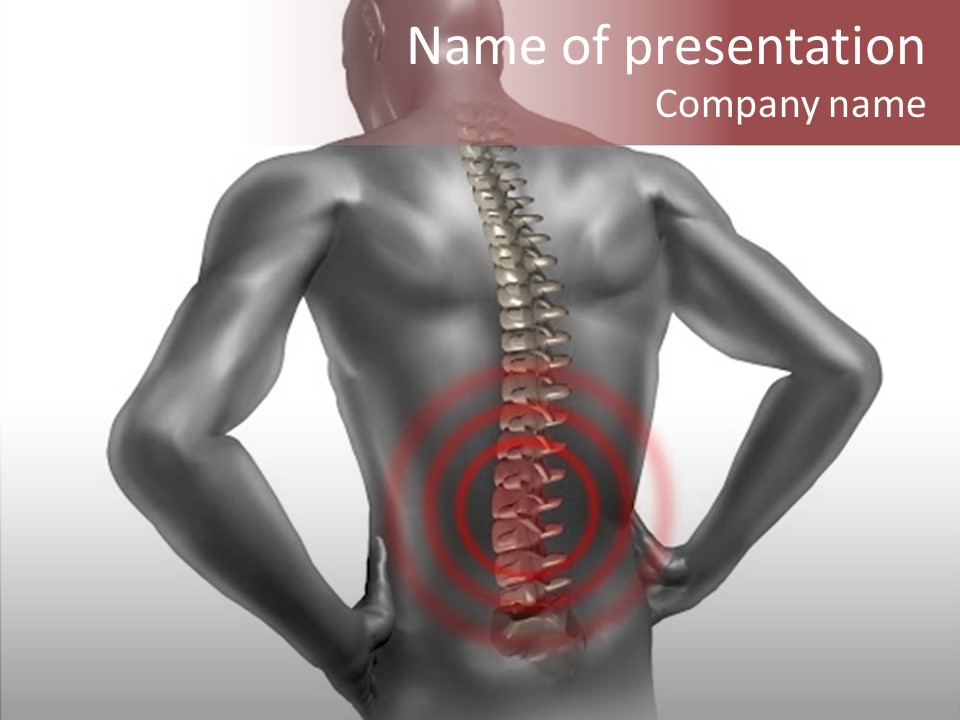 Spine Acupuncture Injury PowerPoint Template