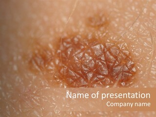 Beauty Patch Dermatology Spot PowerPoint Template