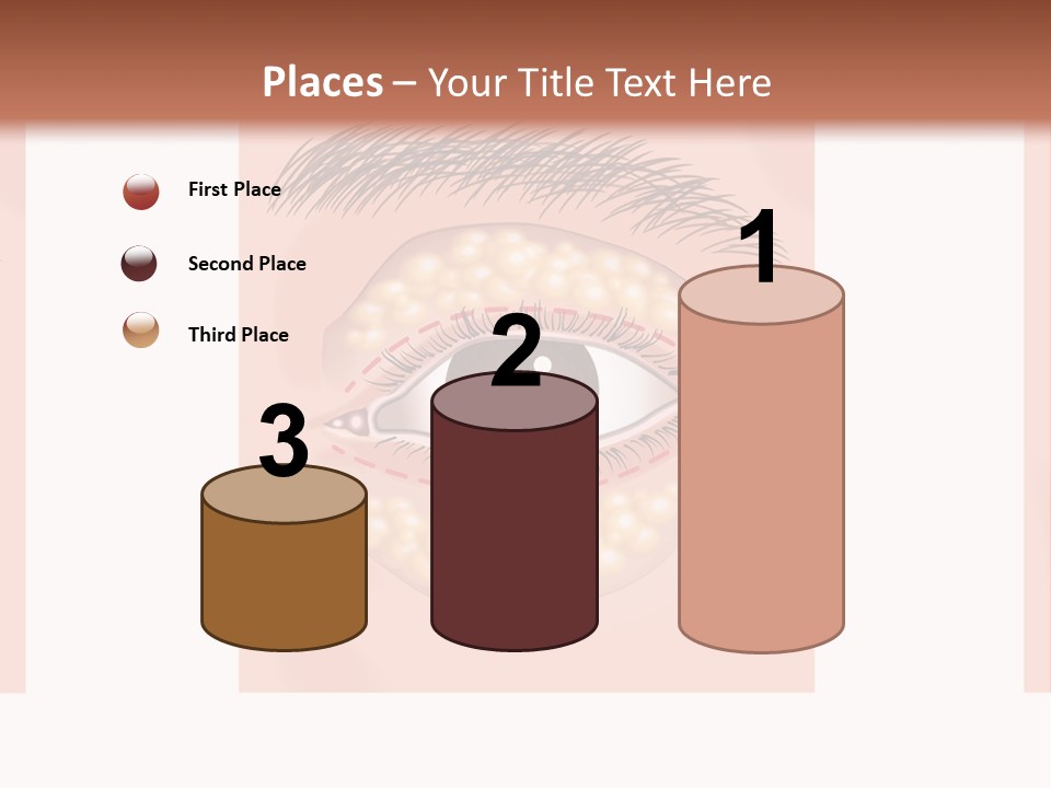 Health Therapy Implant PowerPoint Template