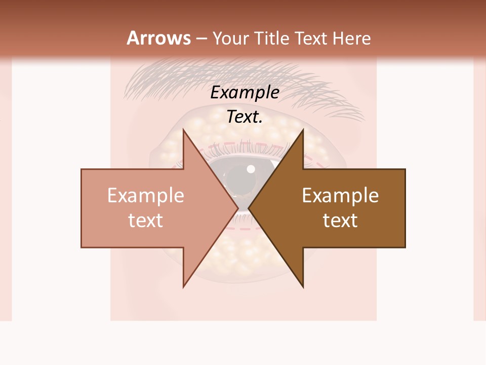 Health Therapy Implant PowerPoint Template