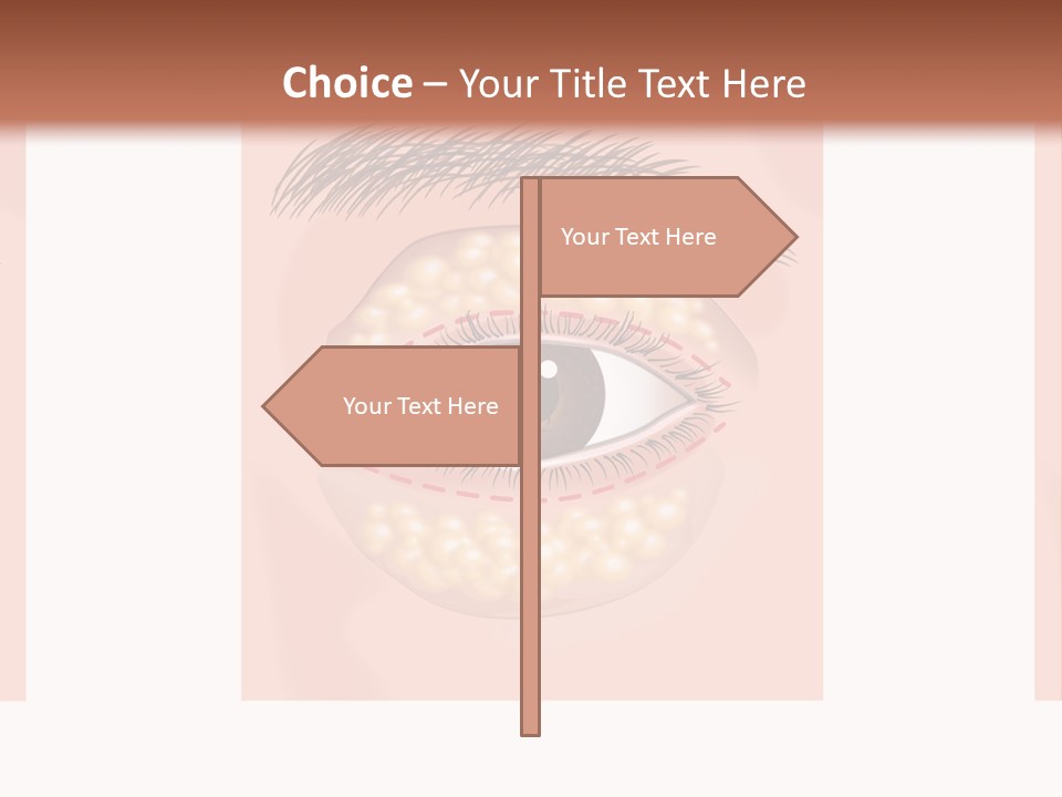 Health Therapy Implant PowerPoint Template
