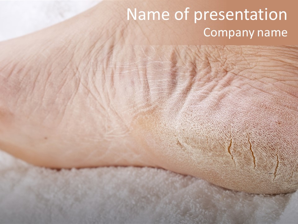 Toe Dry Closeup PowerPoint Template