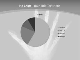 Skeleton Finger Broken PowerPoint Template