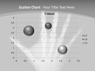 Skeleton Finger Broken PowerPoint Template