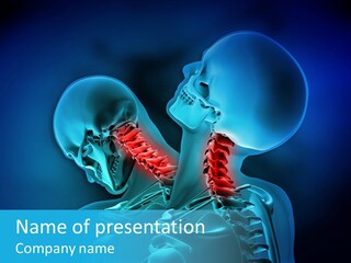 Injury Neck Whiplash PowerPoint Template