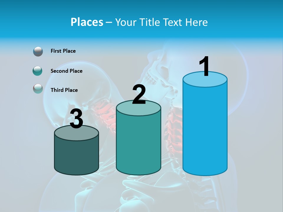 Injury Neck Whiplash PowerPoint Template