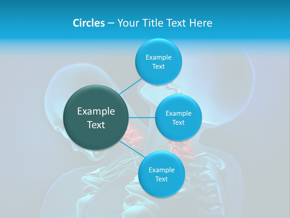 Injury Neck Whiplash PowerPoint Template