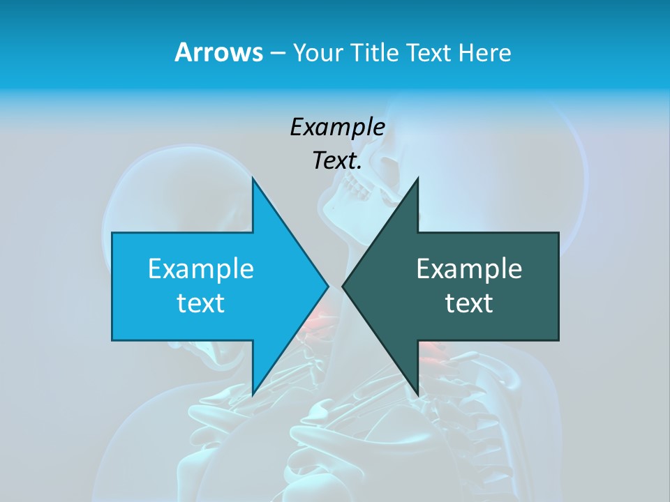 Injury Neck Whiplash PowerPoint Template