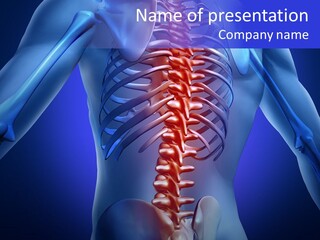 Xray People Pain PowerPoint Template
