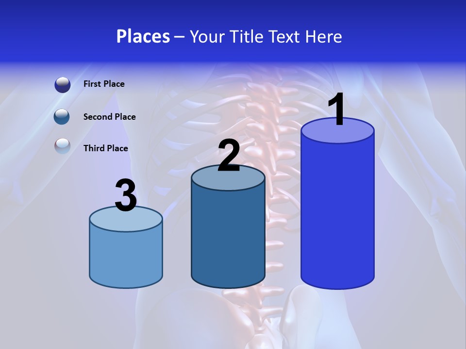 Xray People Pain PowerPoint Template