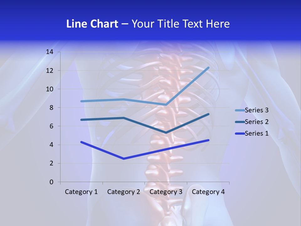 Xray People Pain PowerPoint Template