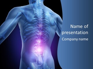 Sports Injury Low Back Pain Skeleton PowerPoint Template