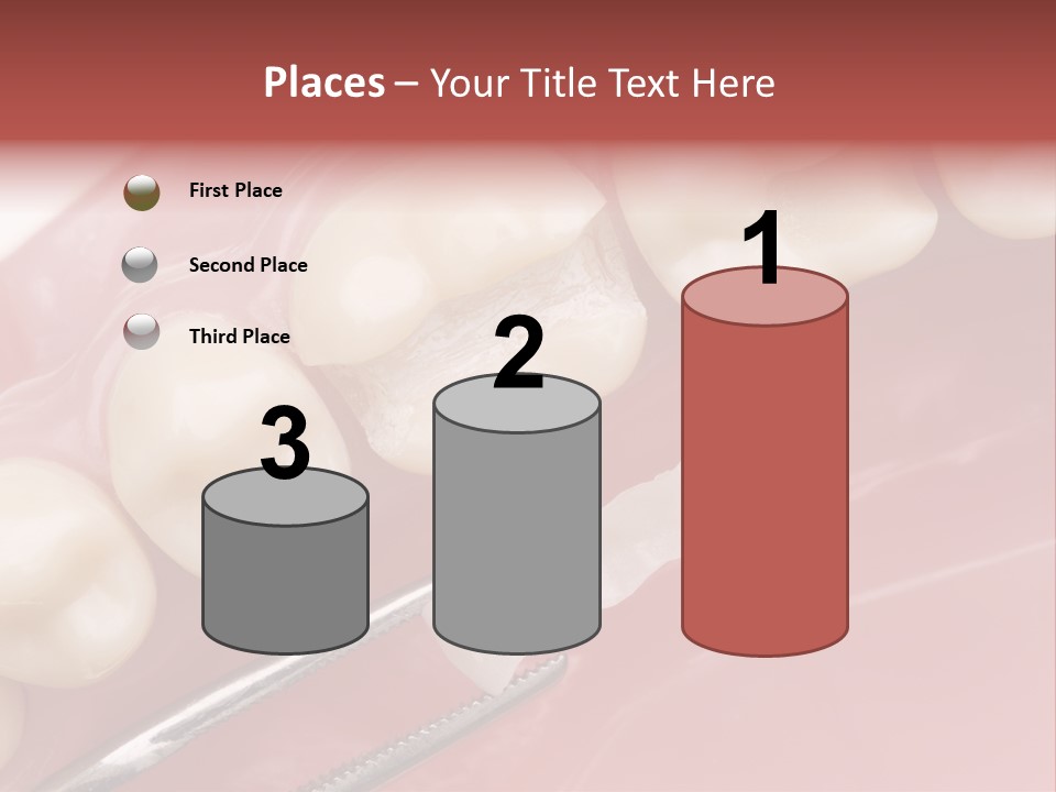 Periodontosis Dentist Ceramics PowerPoint Template
