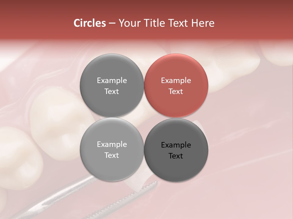 Periodontosis Dentist Ceramics PowerPoint Template