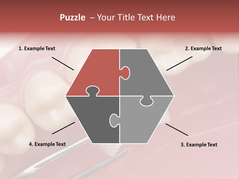 Periodontosis Dentist Ceramics PowerPoint Template