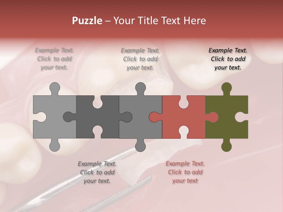 Periodontosis Dentist Ceramics PowerPoint Template