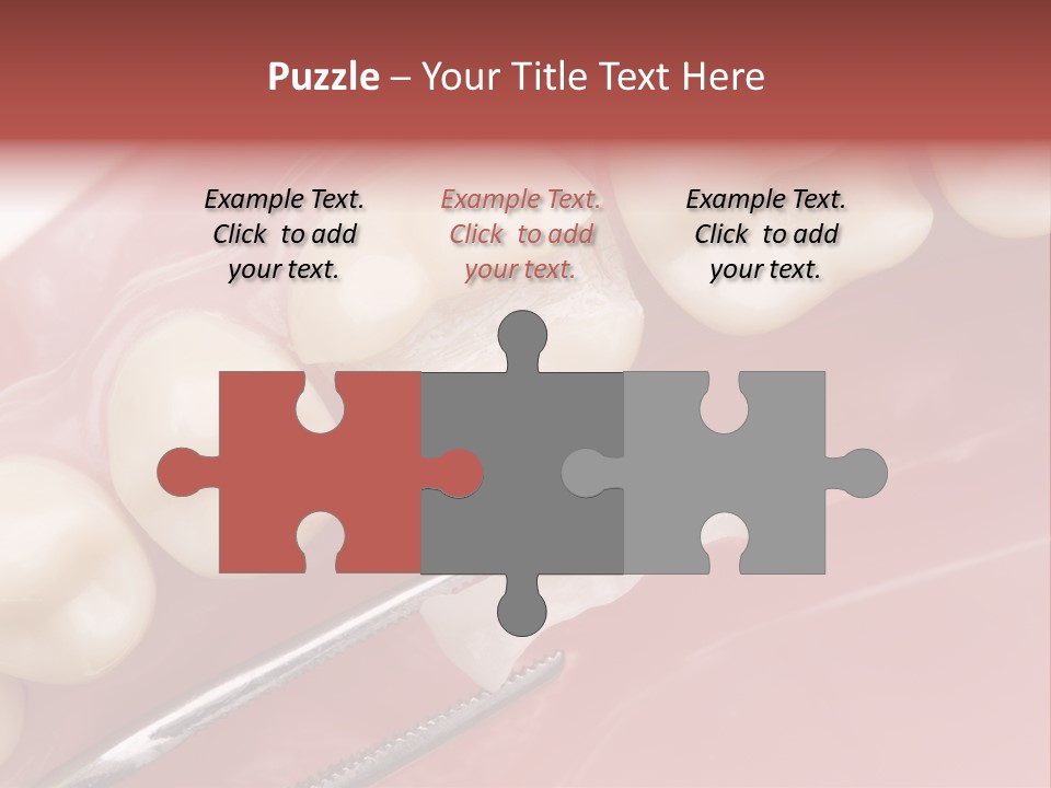 Periodontosis Dentist Ceramics PowerPoint Template