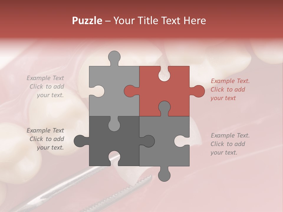 Periodontosis Dentist Ceramics PowerPoint Template