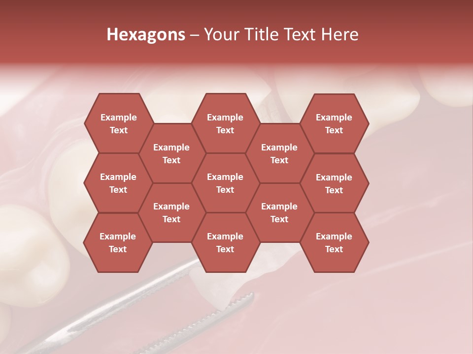 Periodontosis Dentist Ceramics PowerPoint Template