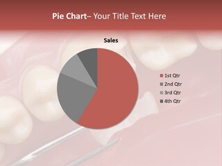 Periodontosis Dentist Ceramics PowerPoint Template