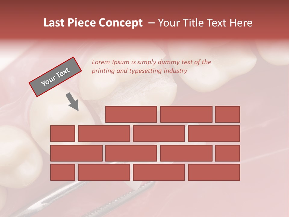 Periodontosis Dentist Ceramics PowerPoint Template