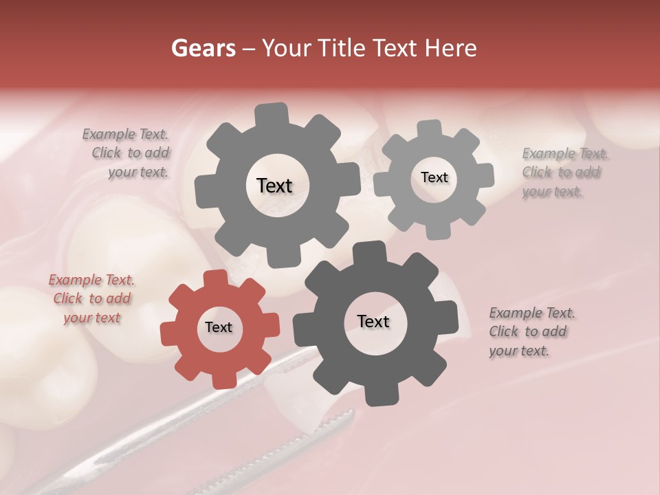 Periodontosis Dentist Ceramics PowerPoint Template