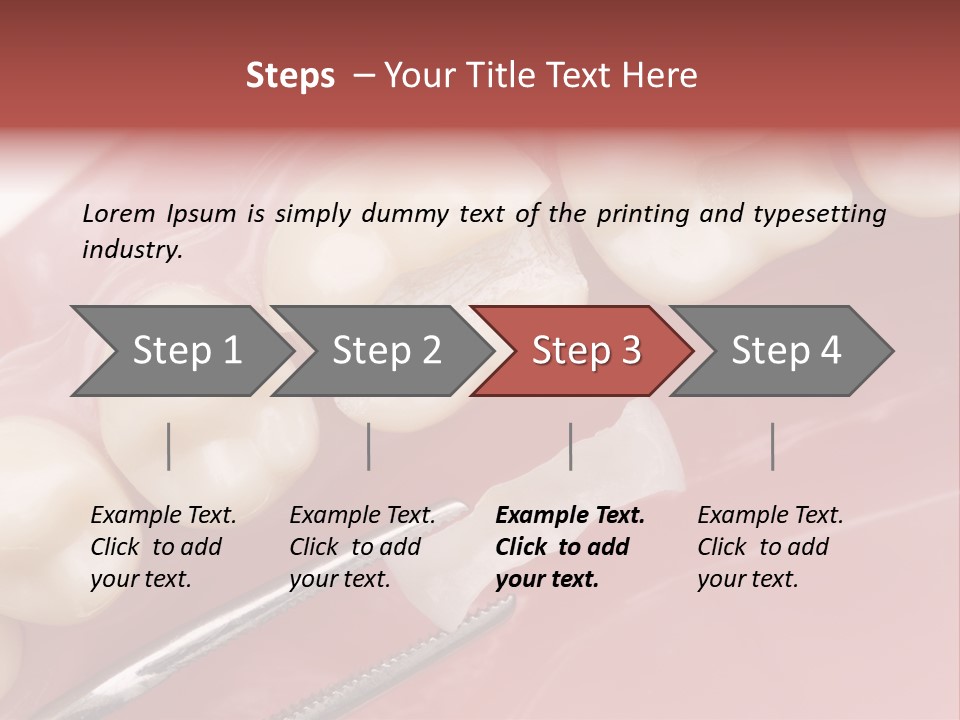 Periodontosis Dentist Ceramics PowerPoint Template