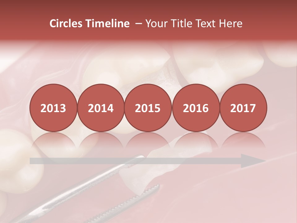 Periodontosis Dentist Ceramics PowerPoint Template