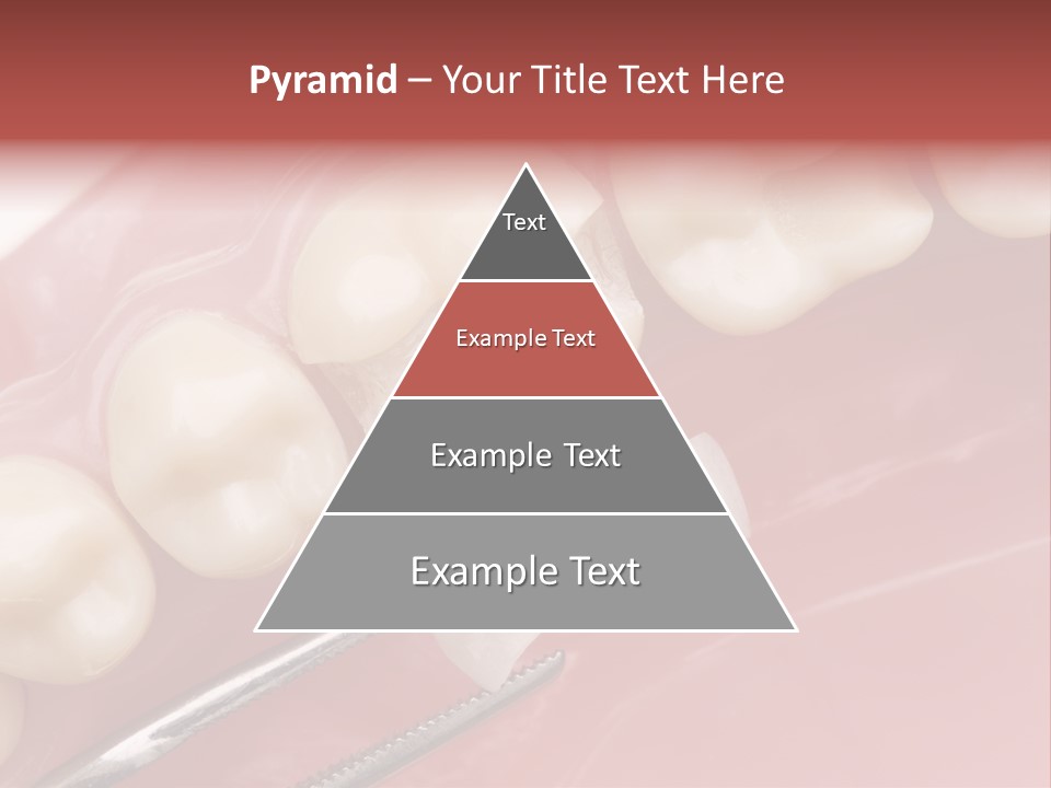 Periodontosis Dentist Ceramics PowerPoint Template