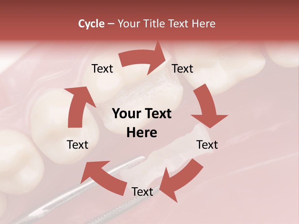 Periodontosis Dentist Ceramics PowerPoint Template