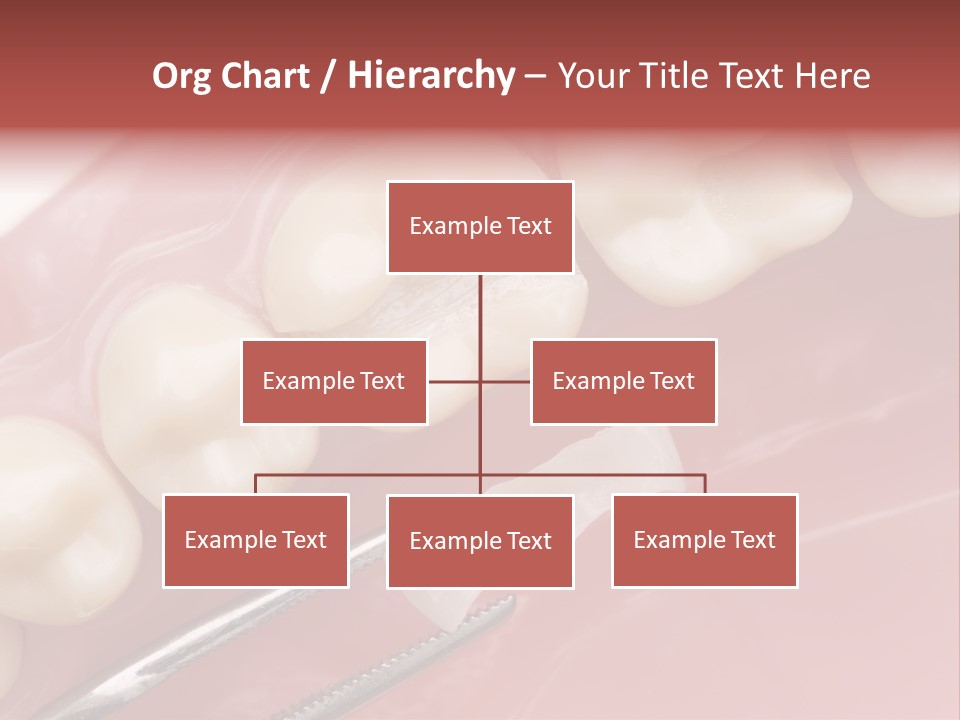 Periodontosis Dentist Ceramics PowerPoint Template