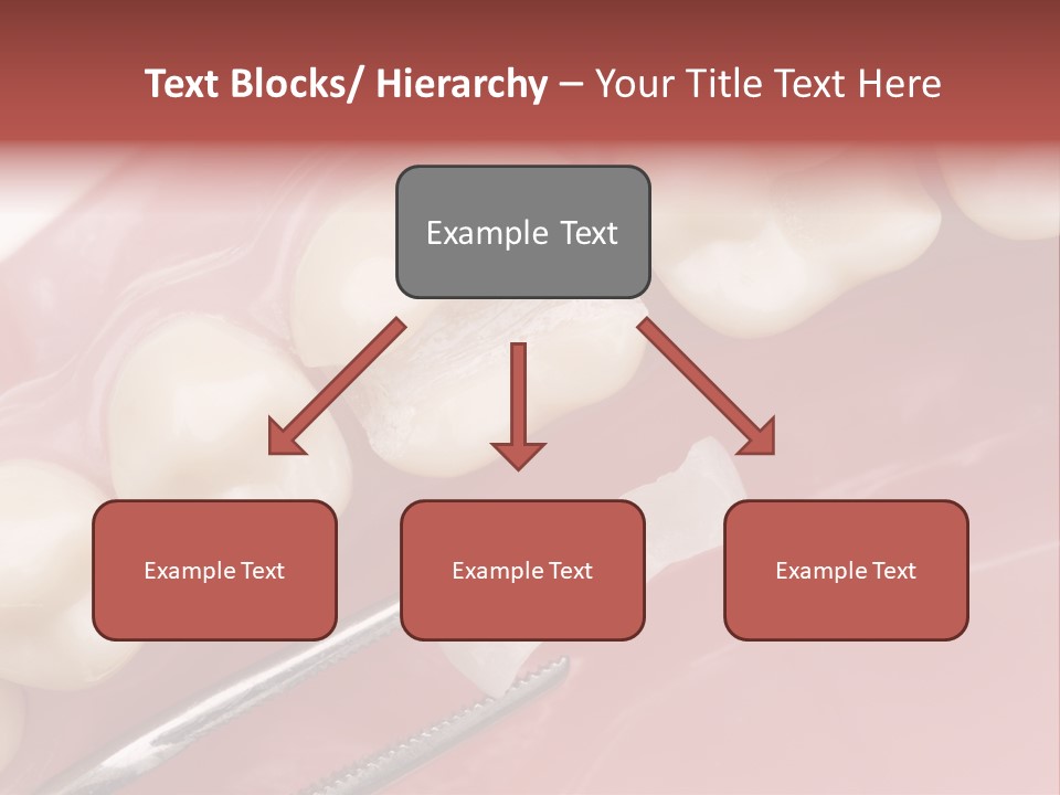 Periodontosis Dentist Ceramics PowerPoint Template