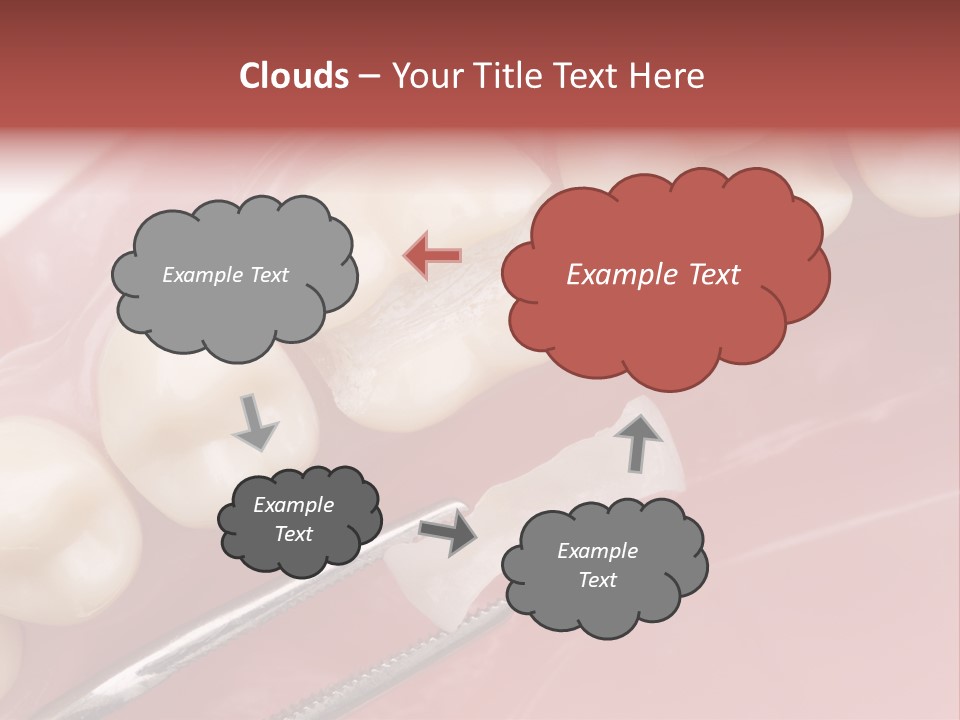 Periodontosis Dentist Ceramics PowerPoint Template