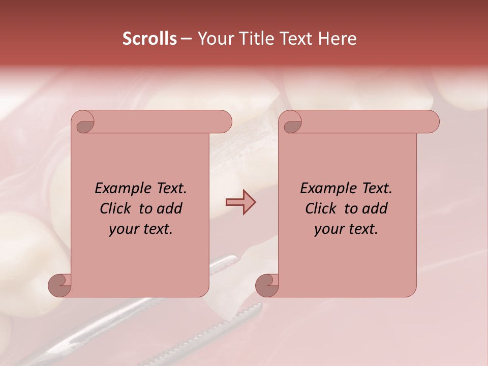 Periodontosis Dentist Ceramics PowerPoint Template