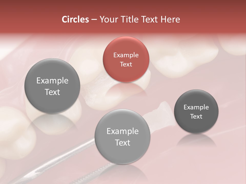 Periodontosis Dentist Ceramics PowerPoint Template