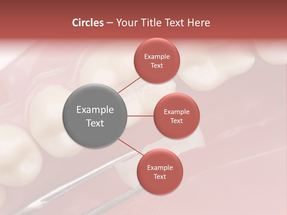 Periodontosis Dentist Ceramics PowerPoint Template