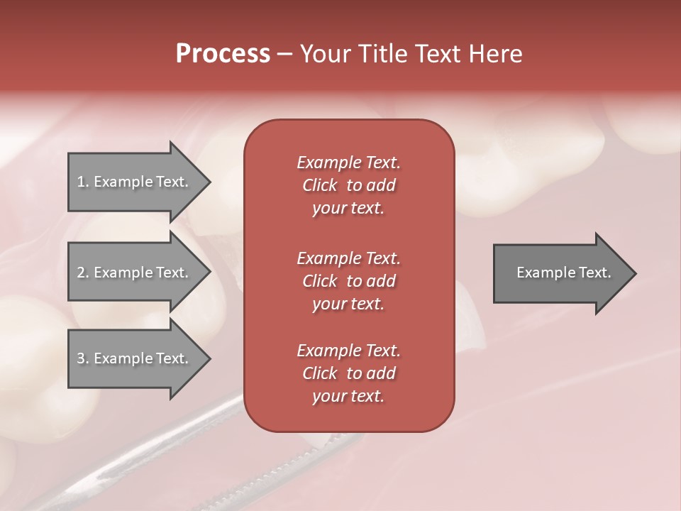 Periodontosis Dentist Ceramics PowerPoint Template