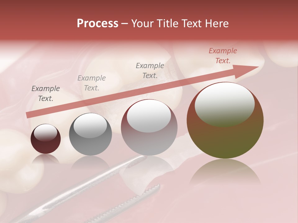 Periodontosis Dentist Ceramics PowerPoint Template