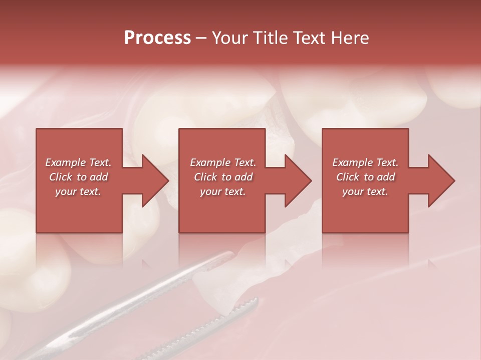 Periodontosis Dentist Ceramics PowerPoint Template