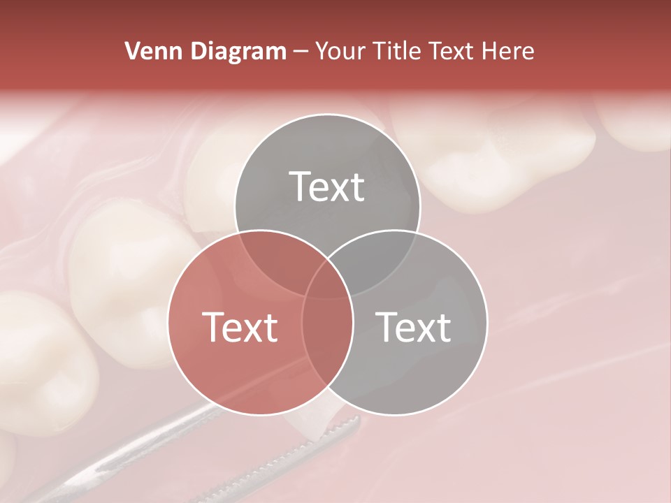 Periodontosis Dentist Ceramics PowerPoint Template