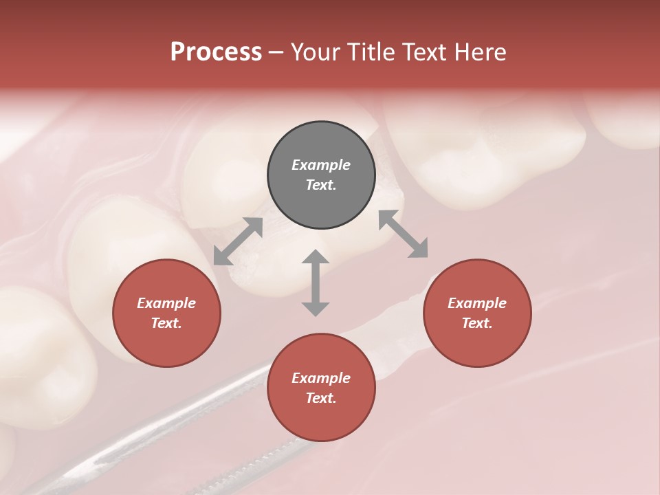 Periodontosis Dentist Ceramics PowerPoint Template