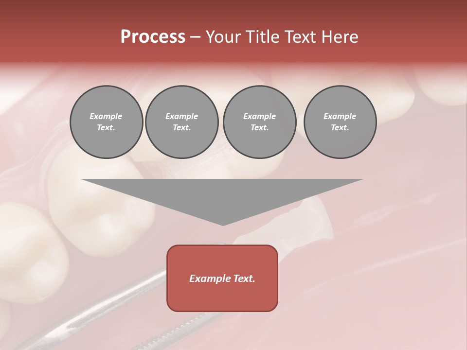 Periodontosis Dentist Ceramics PowerPoint Template