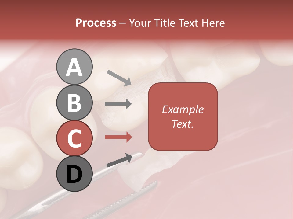 Periodontosis Dentist Ceramics PowerPoint Template