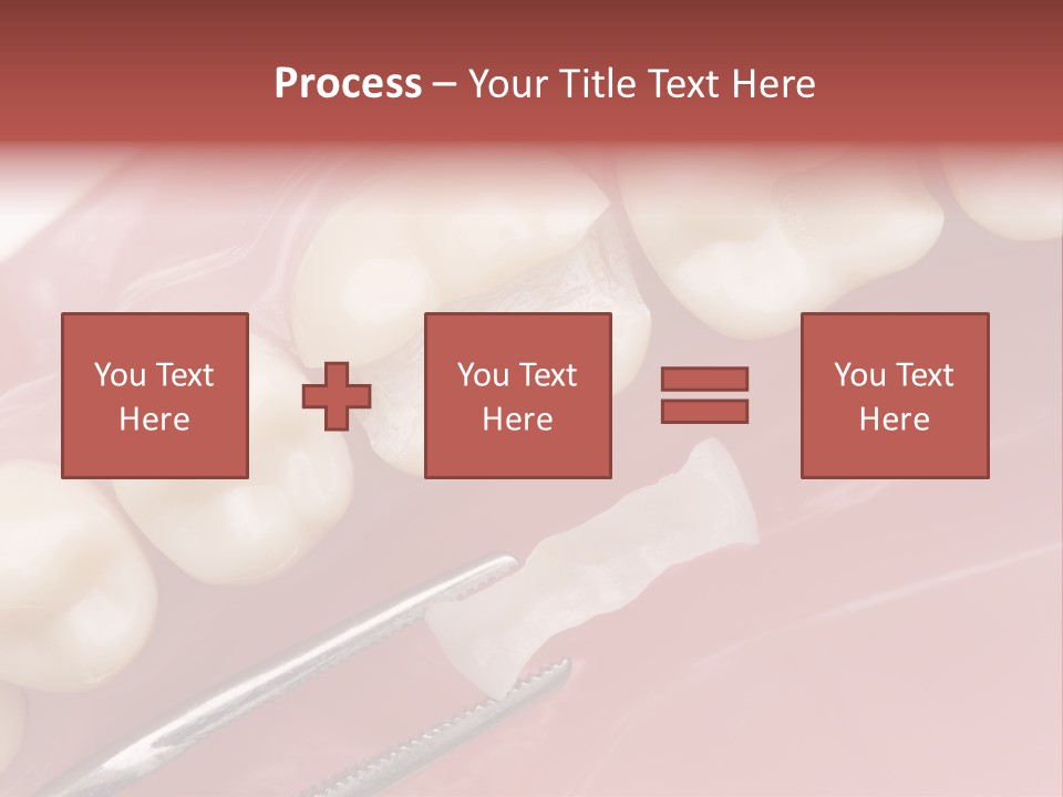 Periodontosis Dentist Ceramics PowerPoint Template