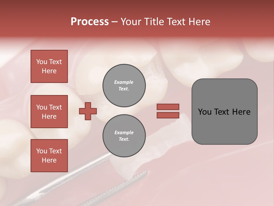 Periodontosis Dentist Ceramics PowerPoint Template
