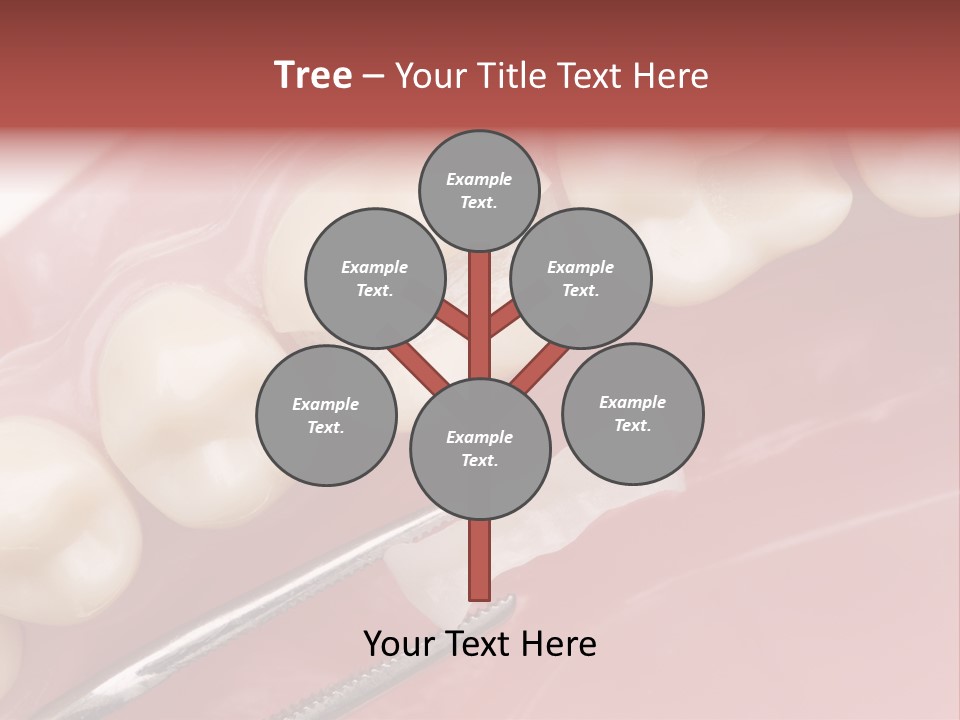 Periodontosis Dentist Ceramics PowerPoint Template