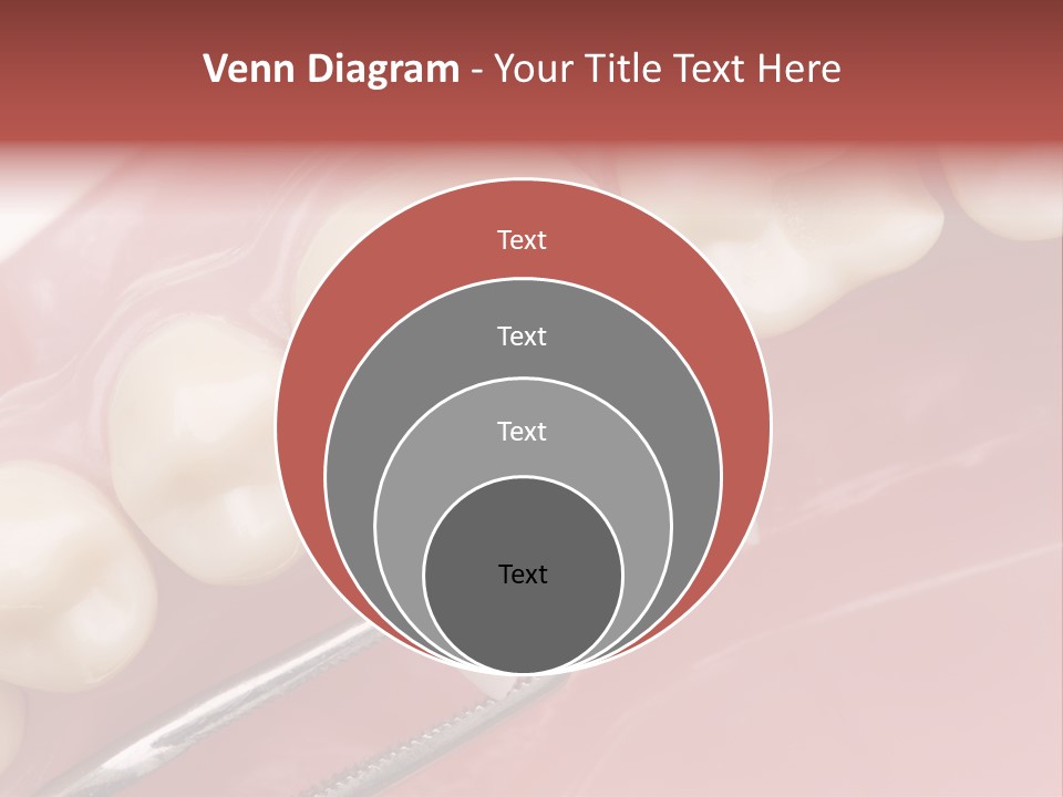 Periodontosis Dentist Ceramics PowerPoint Template