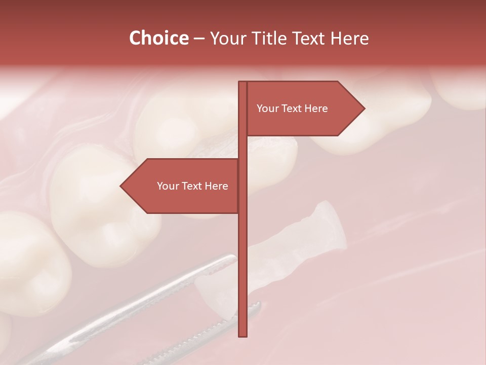 Periodontosis Dentist Ceramics PowerPoint Template