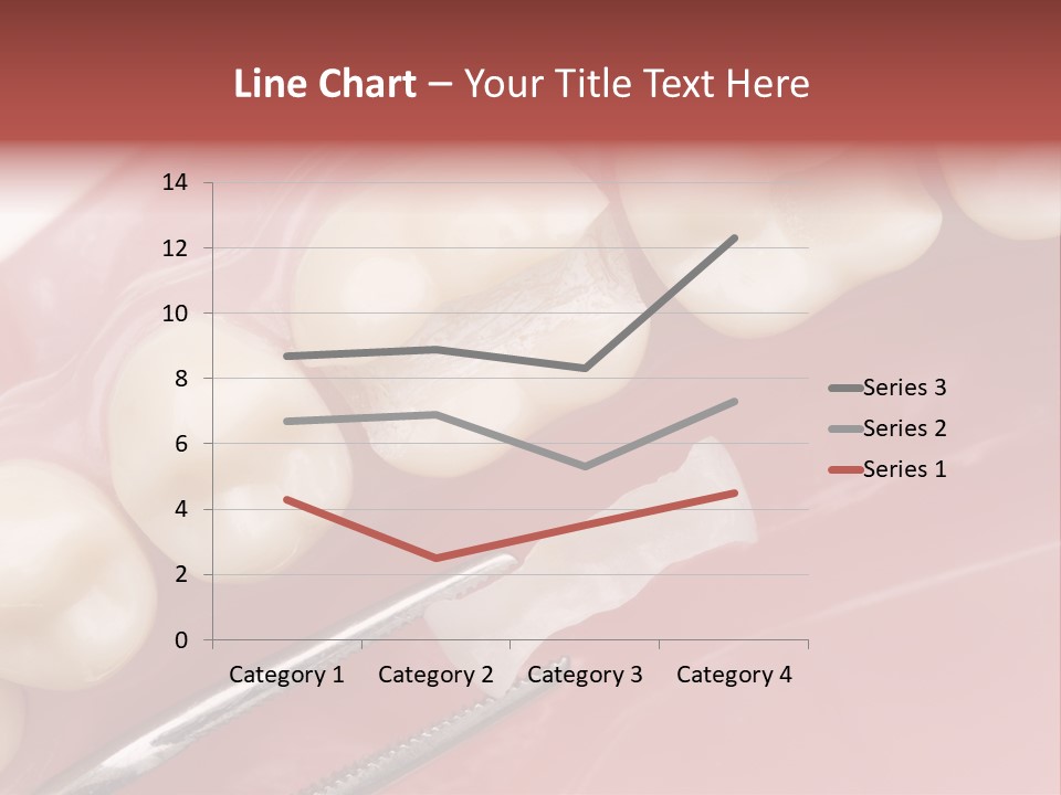 Periodontosis Dentist Ceramics PowerPoint Template