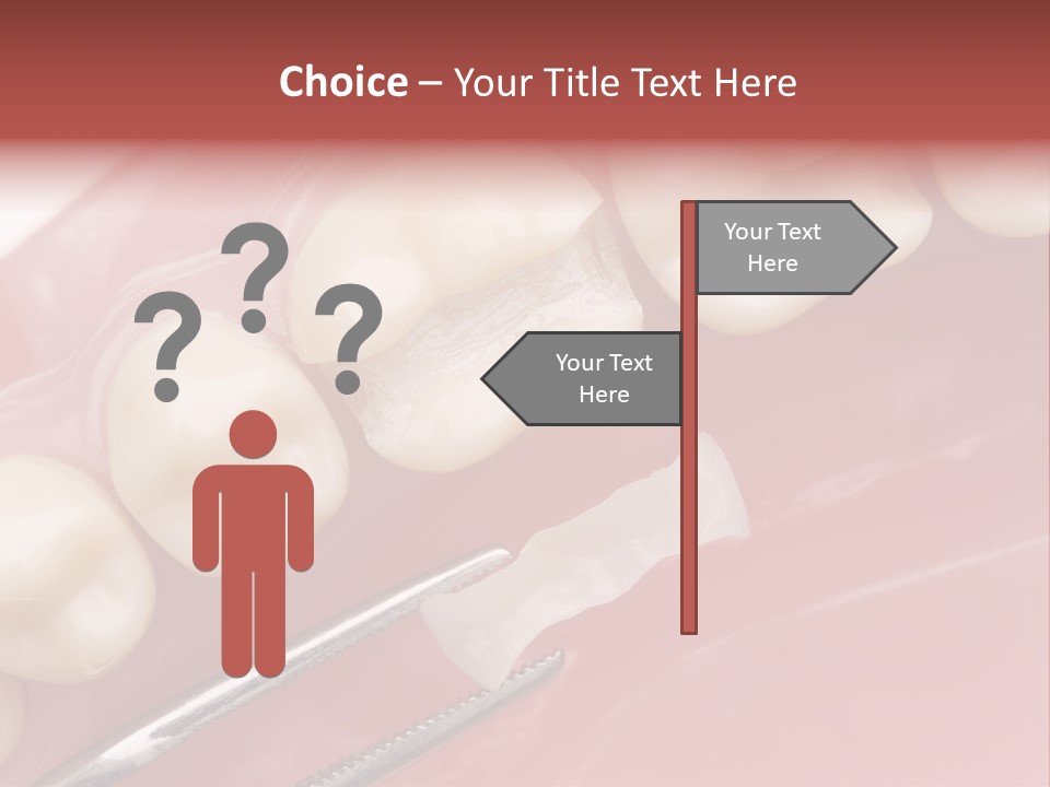 Periodontosis Dentist Ceramics PowerPoint Template
